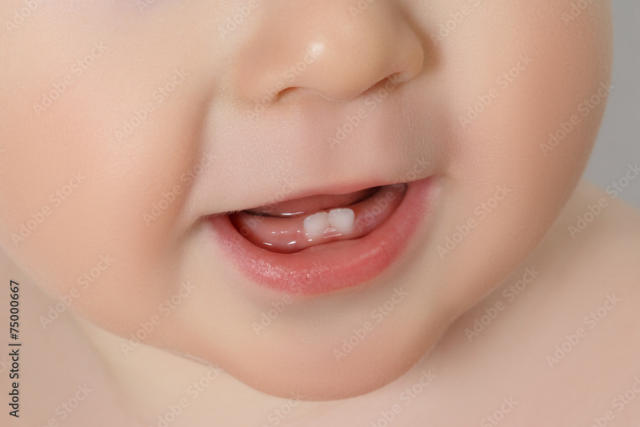 baby mouth with teeth showing